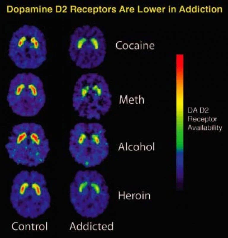 Cocian & Other Drugs Dopamine Receptors